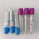 PRP vacuum blood colletion tube Blood Collection Tubes Gel Plasma BD vacuum blood colletion tube Tubes