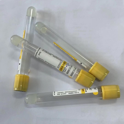 Ống lấy máu chân không dùng một lần trong y tế 5ml Nắp đầu màu vàng