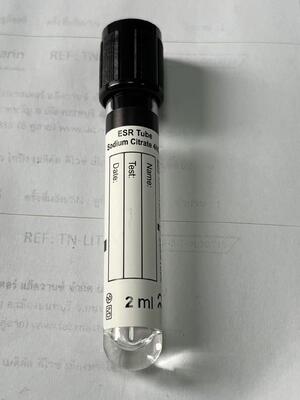 1.6ml ESR ống chân không với 3,8% Natri Citrate cho tỷ lệ trầm tích