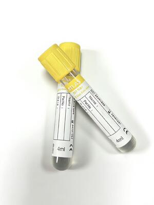 Ống nghiệm SST: Đông máu huyết thanh nhanh & Tách biệt vượt trội cho các phòng xét nghiệm cốt lõi