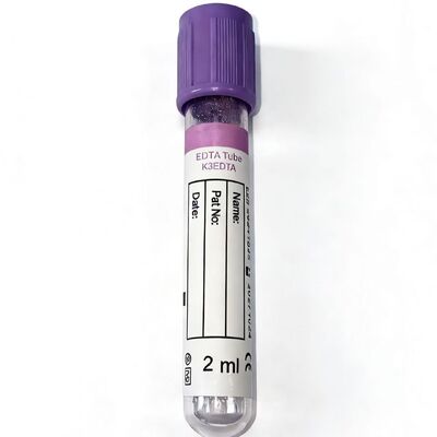 Các ống EDTA toàn máu: Quan trọng đối với máu học và tính toàn vẹn của xét nghiệm phân tử